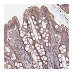 Atlas Antibodies Anti-ARHGEF39 Antibody