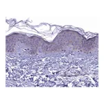 Atlas Antibodies Anti-ARHGEF37 Antibody