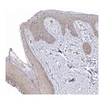 Atlas Antibodies Anti-ARHGEF37 Antibody