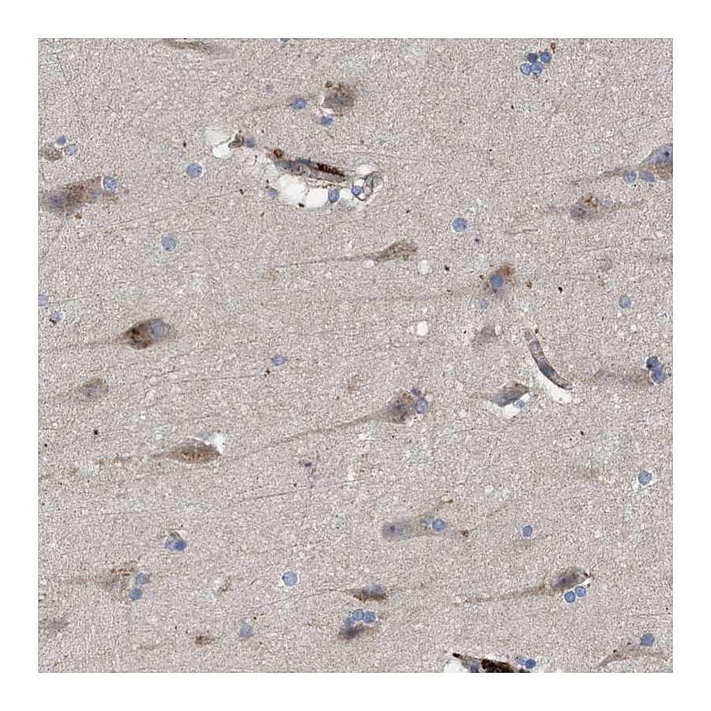 Atlas Antibodies Anti-ARHGEF4 Antibody