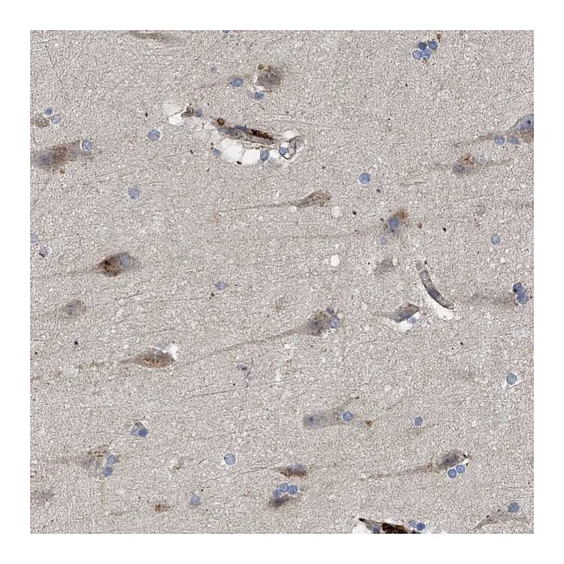 Atlas Antibodies Anti-ARHGEF4 Antibody