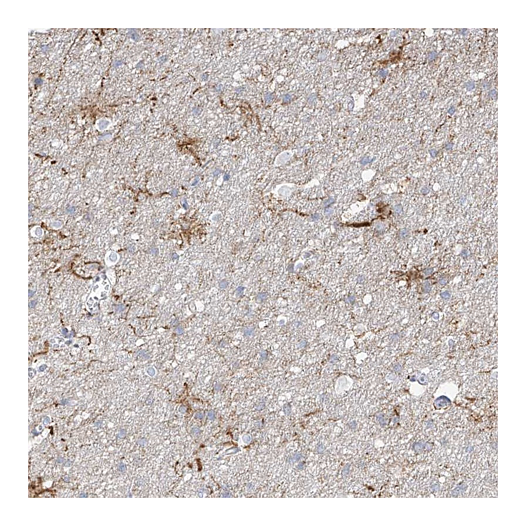 Atlas Antibodies Anti-ARHGEF40 Antibody