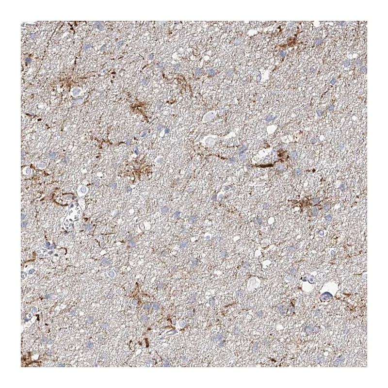 Atlas Antibodies Anti-ARHGEF40 Antibody