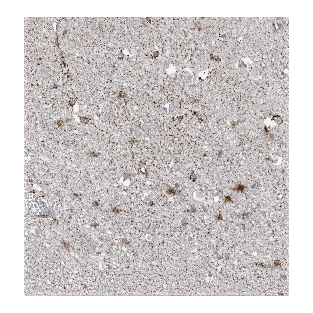 Atlas Antibodies Anti-ARHGEF40 Antibody