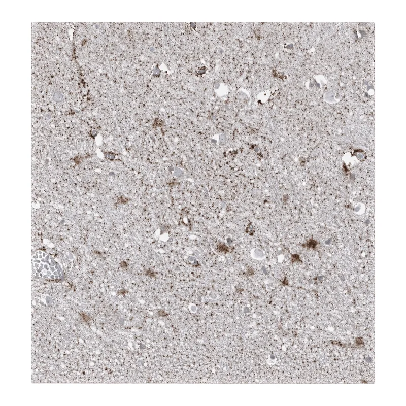 Atlas Antibodies Anti-ARHGEF40 Antibody