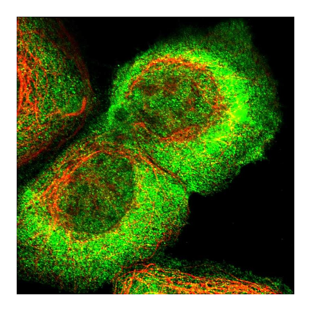 Atlas Antibodies Anti-ARHGEF5 Antibody