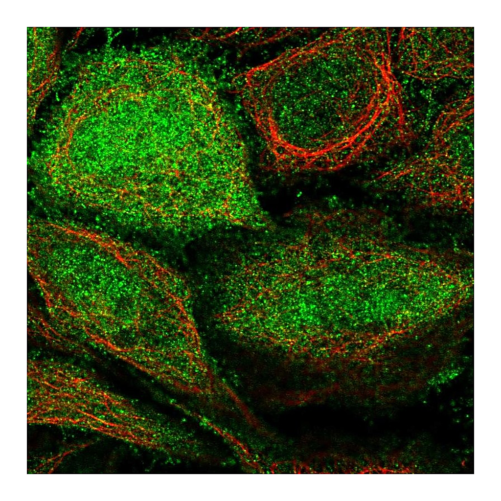 Atlas Antibodies Anti-ARHGEF5 Antibody