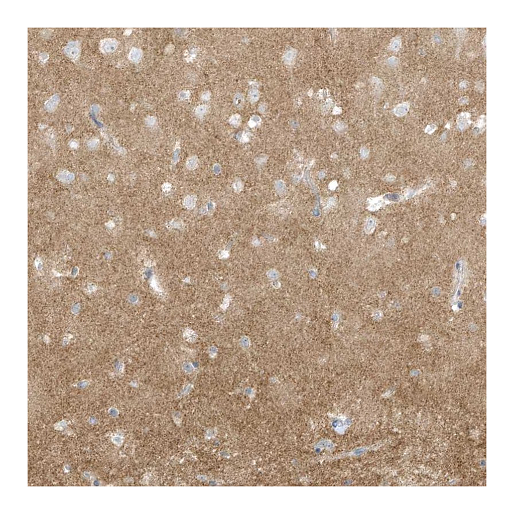 Atlas Antibodies Anti-ARHGEF9 Antibody