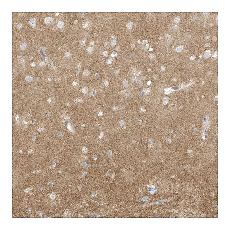 Atlas Antibodies Anti-ARHGEF9 Antibody