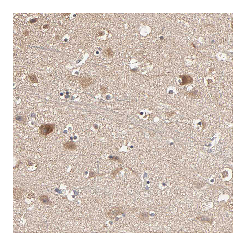 Atlas Antibodies Anti-ARHGEF7 Antibody