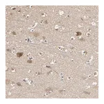 Atlas Antibodies Anti-ARHGEF7 Antibody
