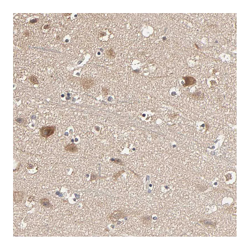Atlas Antibodies Anti-ARHGEF7 Antibody
