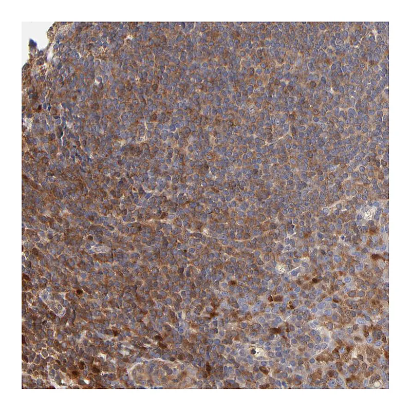 Atlas Antibodies Anti-ARHGEF6 Antibody