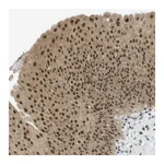 Atlas Antibodies Anti-ARID1B Antibody