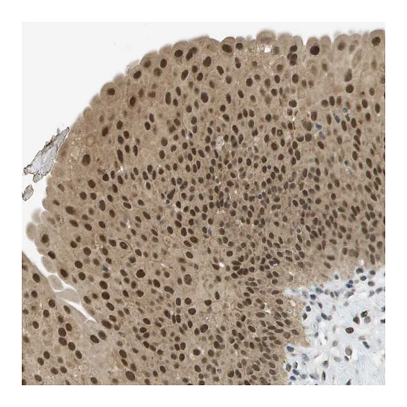 Atlas Antibodies Anti-ARID1B Antibody