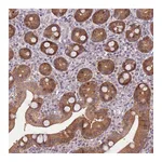 Atlas Antibodies Anti-ARHGEF5 Antibody