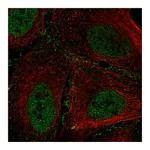 Atlas Antibodies Anti-ARID1B Antibody