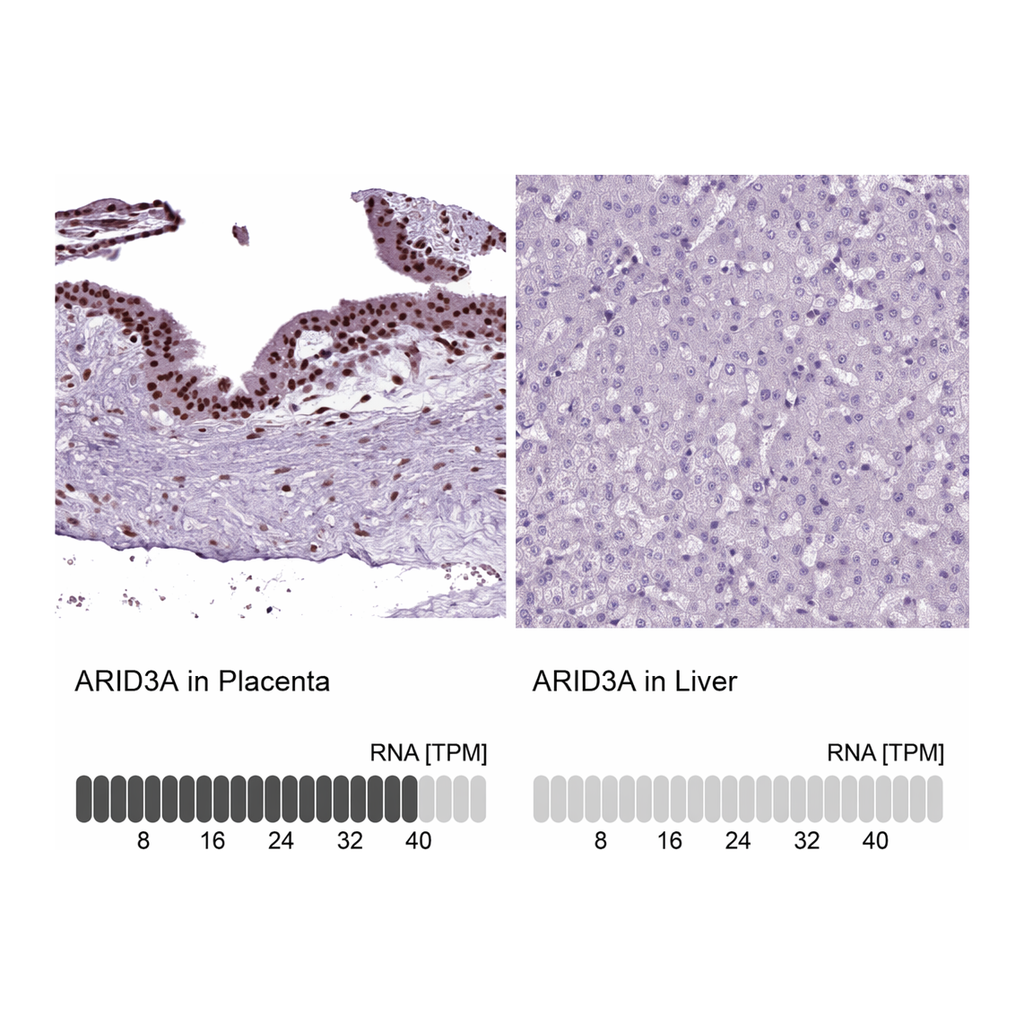 Atlas Antibodies Anti-ARID3A Antibody