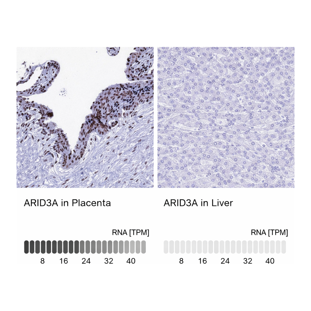 Atlas Antibodies Anti-ARID3A Antibody