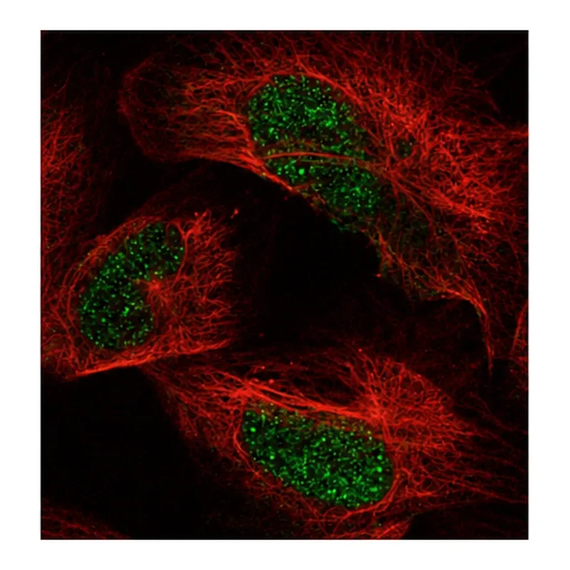 Atlas Antibodies Anti-ARID2 Antibody