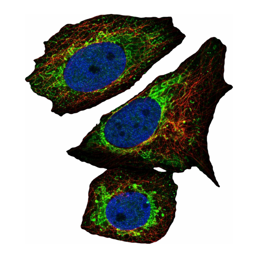 Atlas Antibodies Anti-ARID4B Antibody