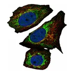 Atlas Antibodies Anti-ARID4B Antibody