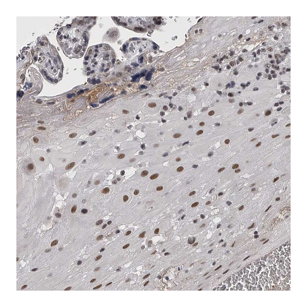 Atlas Antibodies Anti-ARID4B Antibody