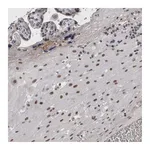 Atlas Antibodies Anti-ARID4B Antibody