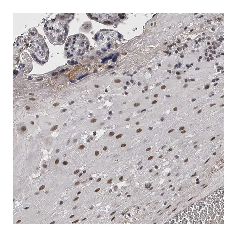 Atlas Antibodies Anti-ARID4B Antibody