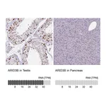 Atlas Antibodies Anti-ARID3B Antibody