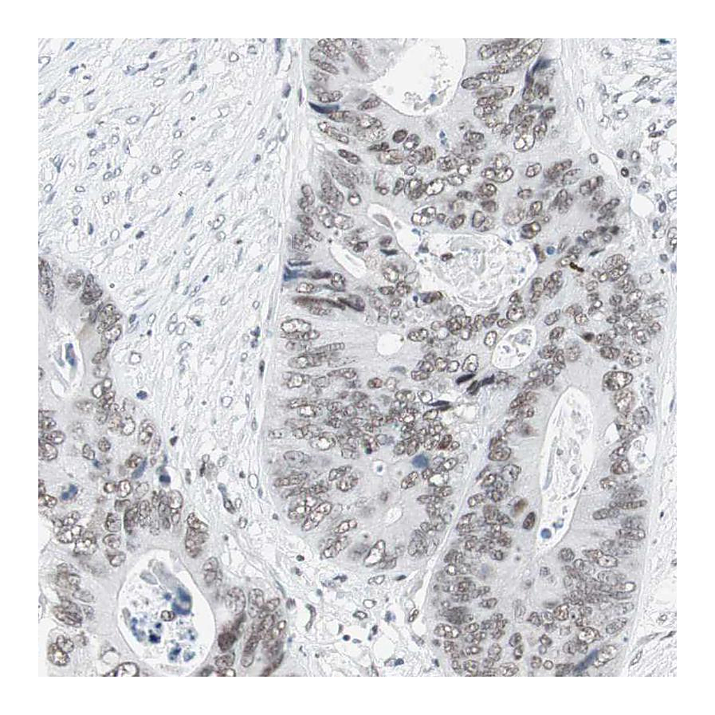 Atlas Antibodies Anti-ARID1A Antibody