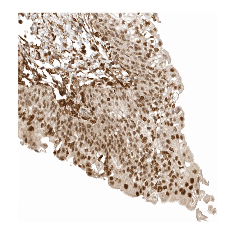 Atlas Antibodies Anti-ARID5A Antibody