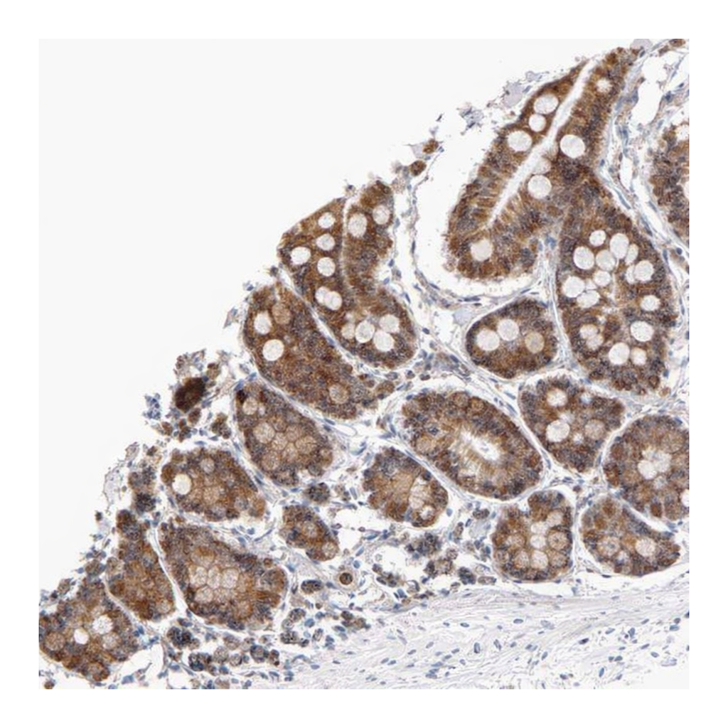 Atlas Antibodies Anti-ARIH1 Antibody