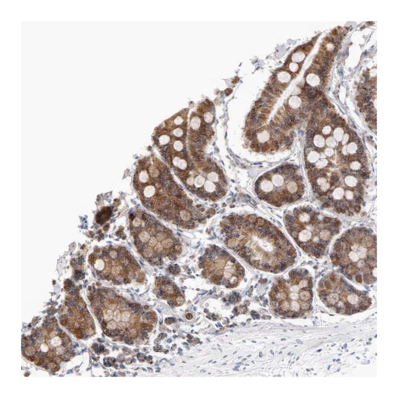 Atlas Antibodies Anti-ARIH1 Antibody
