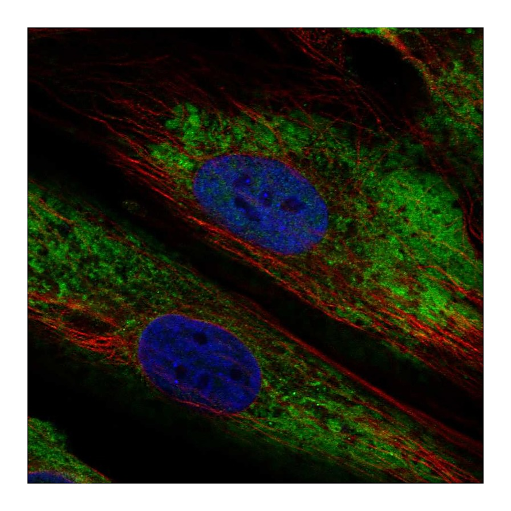Atlas Antibodies Anti-ARID5B Antibody