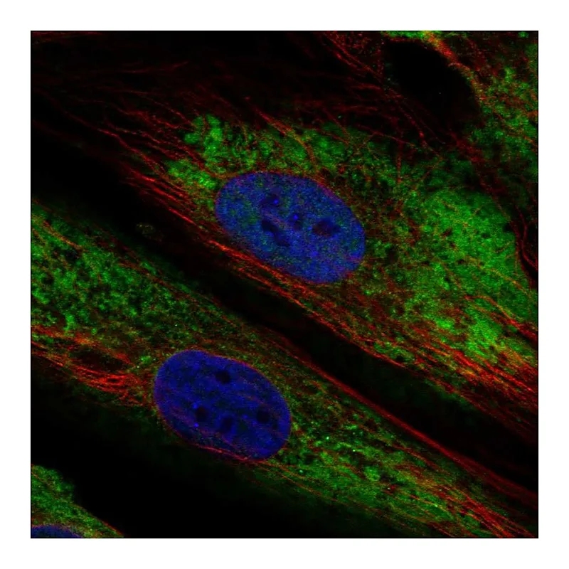 Atlas Antibodies Anti-ARID5B Antibody