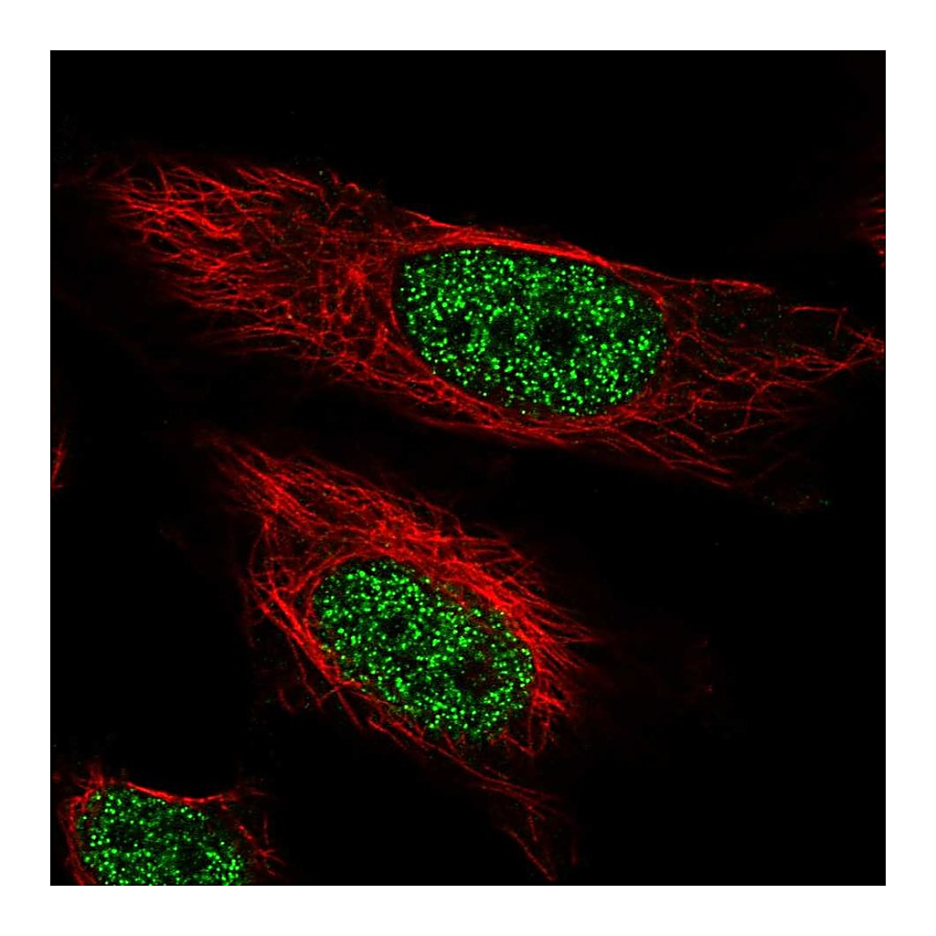 Atlas Antibodies Anti-ARIH2 Antibody