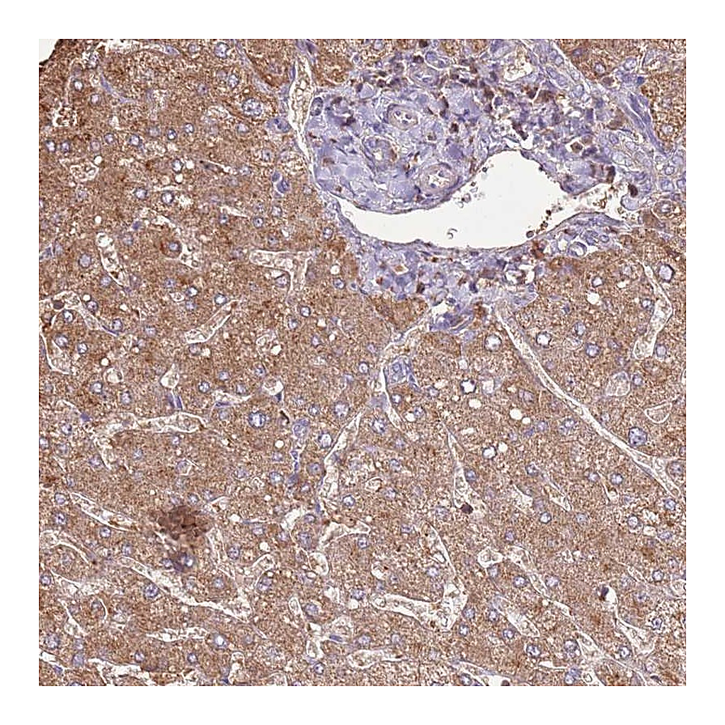 Atlas Antibodies Anti-ARL10 Antibody