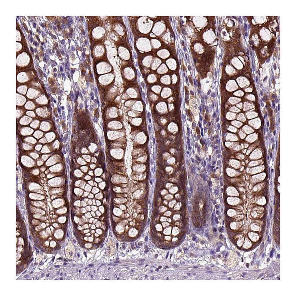 Atlas Antibodies Anti-ARL1 Antibody