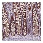 Atlas Antibodies Anti-ARL1 Antibody