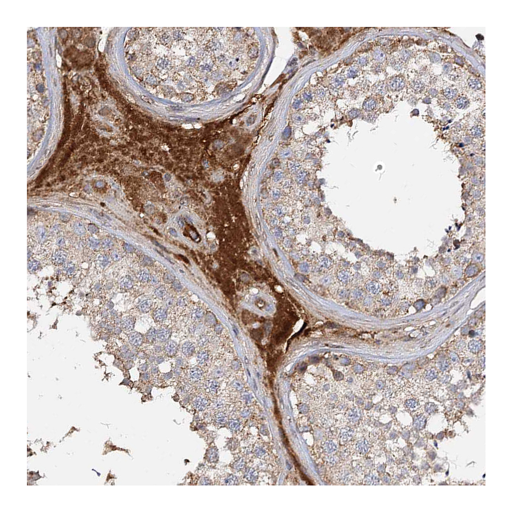 Atlas Antibodies Anti-ARL13A Antibody