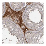 Atlas Antibodies Anti-ARL13A Antibody