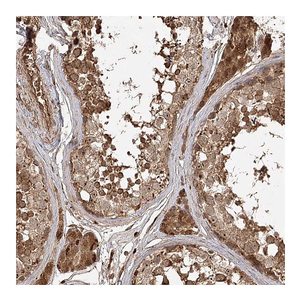 Atlas Antibodies Anti-ARL13A Antibody