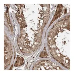 Atlas Antibodies Anti-ARL13A Antibody
