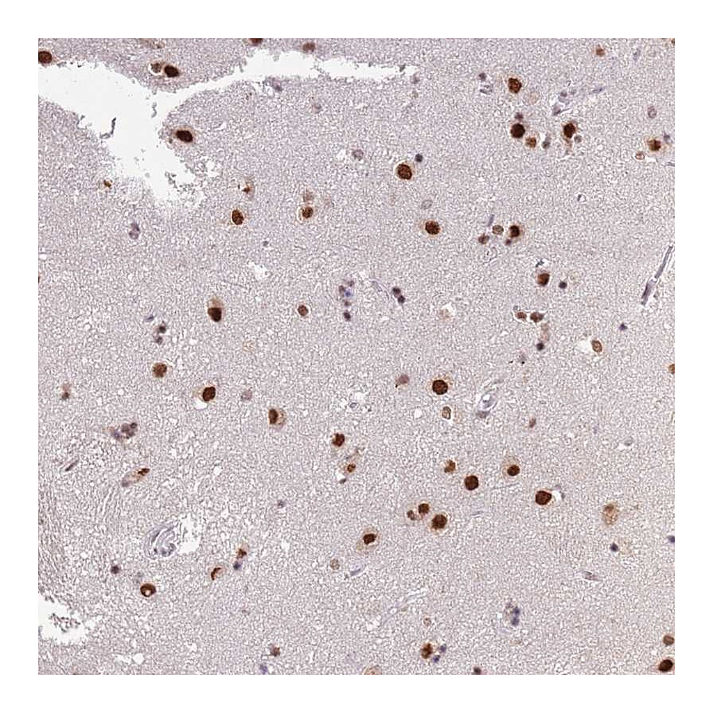 Atlas Antibodies Anti-ARL14EP Antibody