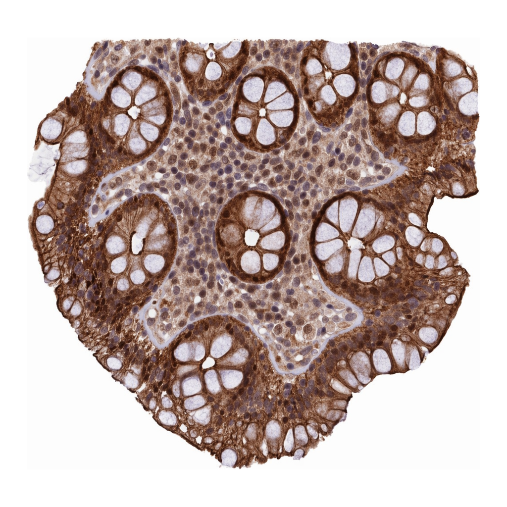 Atlas Antibodies Anti-ARL14EP Antibody