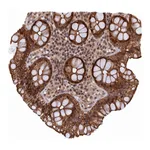 Atlas Antibodies Anti-ARL14EP Antibody