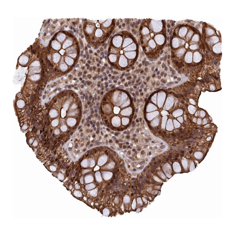Atlas Antibodies Anti-ARL14EP Antibody