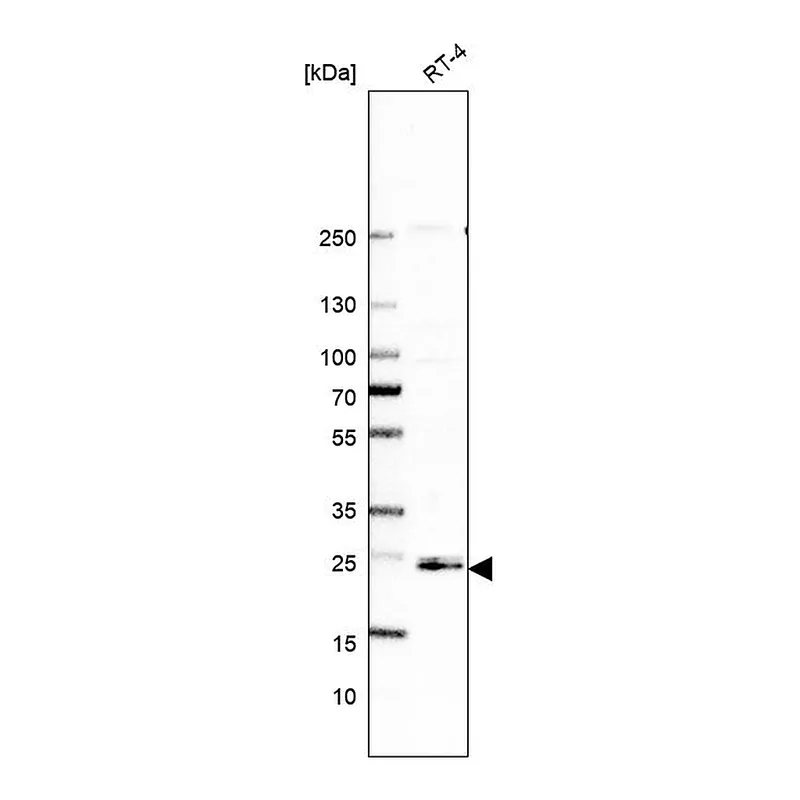 Atlas Antibodies Anti-ARL15 Antibody