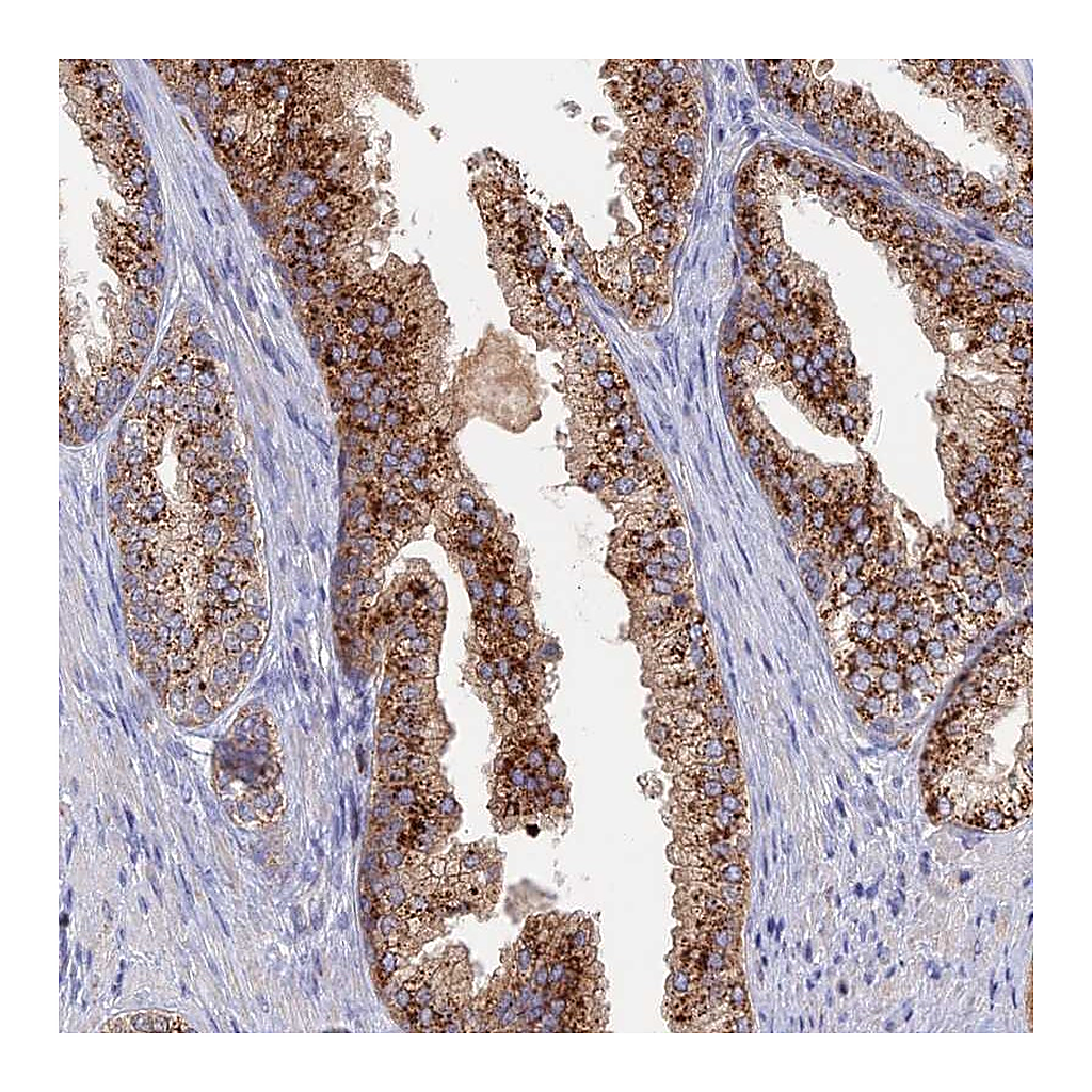 Atlas Antibodies Anti-ARL16 Antibody